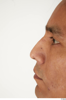 Photos of Moises Molina nose 0002.jpg